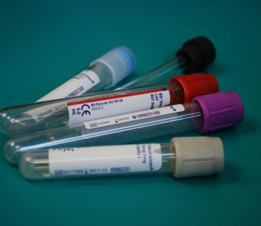 Ministrstvo izdalo navodila, spremembo odredbe in način financiranja hitrih antigenskih testov